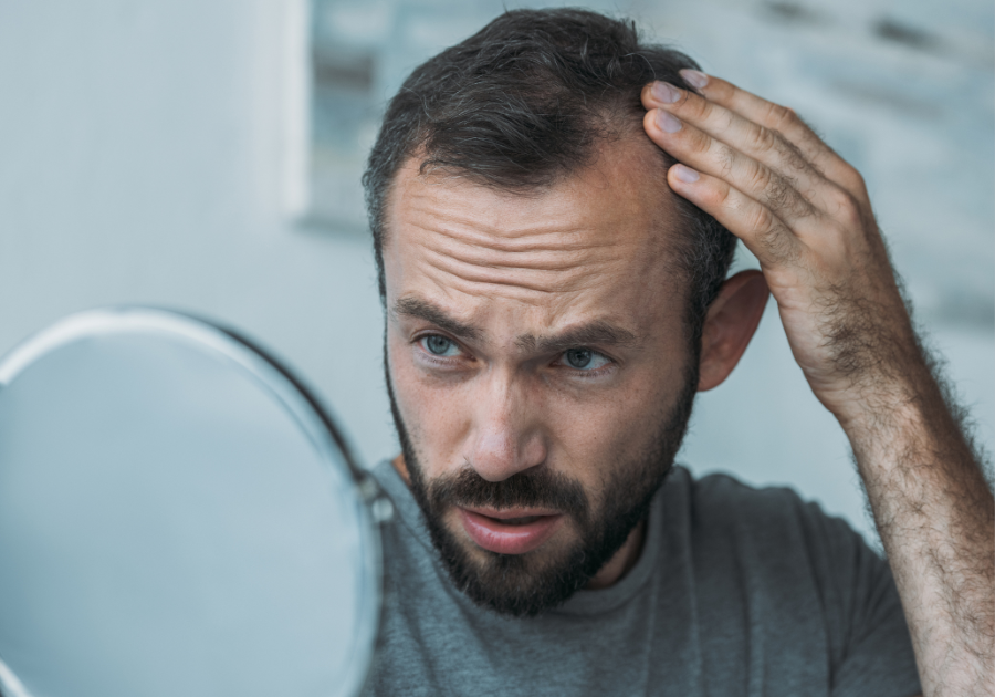 how to treat hair loss in men